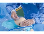 Tıbbi Tek Kullanımlık Cerrahi Paketler Steril Diz Artroskopi Paketi Özelleştirilmiş