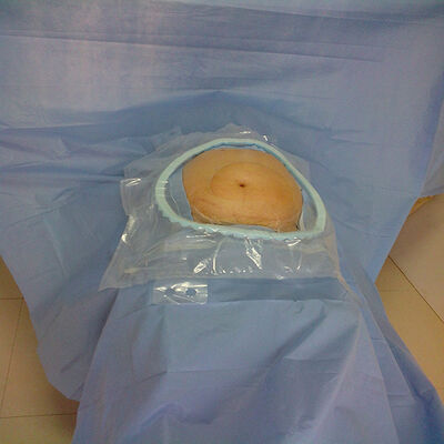 Hastane Acil Servisi için Güçlendirilmiş Emici Kritik Bölgelere Sahip Yüksek Emicili Tek Kullanımlık Cerrahi Paketler ve EO Sterilizasyonu